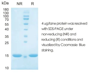 Human IL1a Recombinant Protein (HEK293 Expression) — Tag Free