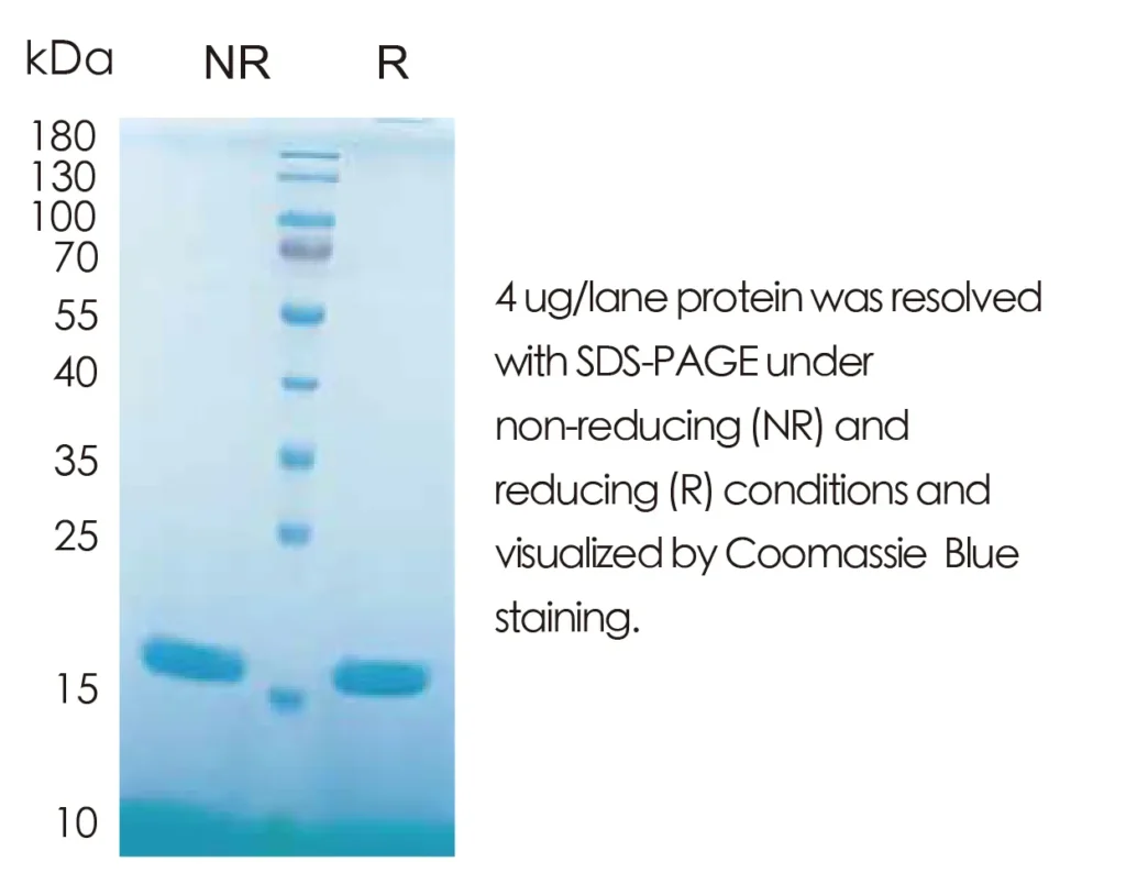 Human IL1b Recombinant Protein (HEK293 Expression) — Tag Free - Image 1