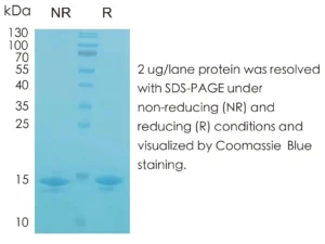 Human IL2 Recombinant Protein (HEK293 Expression) — Tag Free
