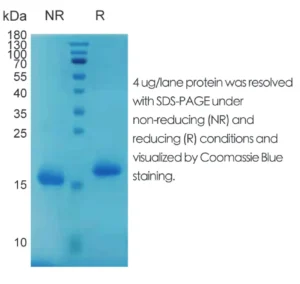 Human IL4 Recombinant Protein (HEK293 Expression) — Tag Free