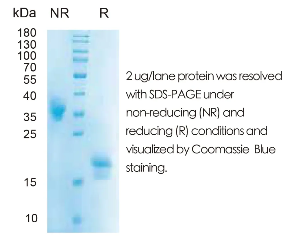 Human IL5 Recombinant Protein (HEK293 Expression) — Tag Free - Image 1