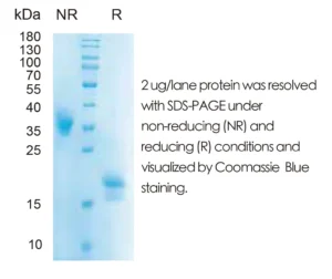 Human IL5 Recombinant Protein (HEK293 Expression) — Tag Free