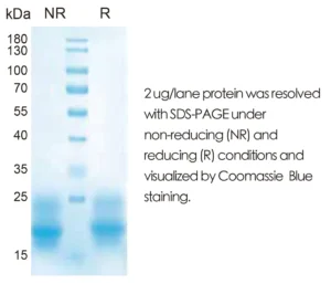 Human IL6 Recombinant Protein (HEK293 Expression) — Tag Free