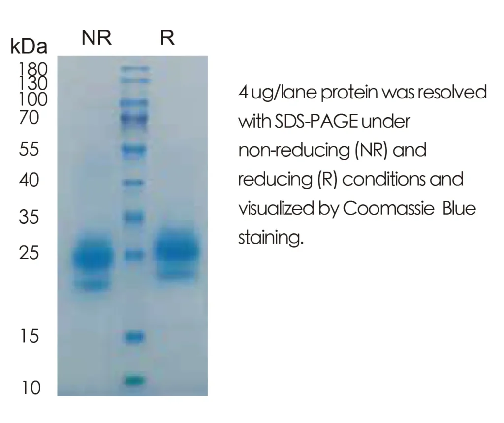 Human IL7 Recombinant Protein (HEK293 Expression) — Tag Free - Image 1