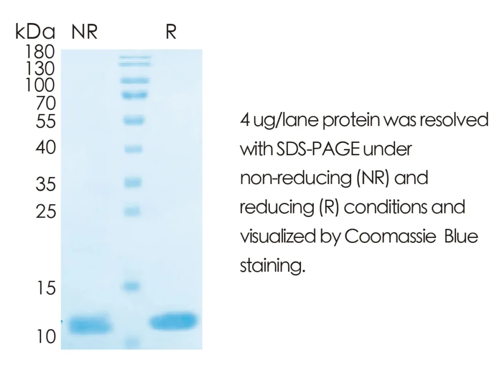 Human IL8 Recombinant Protein (HEK293 Expression) — Tag Free - Image 1