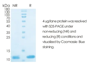 Human IL8 Recombinant Protein (HEK293 Expression) — Tag Free