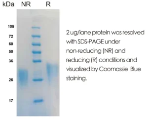 Human IL9 Recombinant Protein (HEK293 Expression) — Tag Free