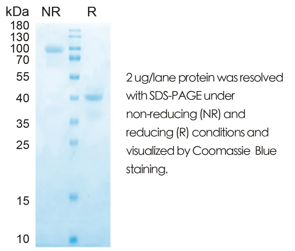 Human IL12 Recombinant Protein (HEK293 Expression) - Image 1