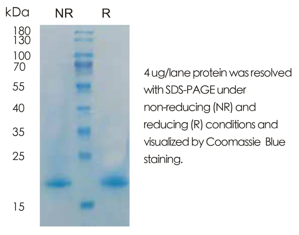 Human IL13 Recombinant Protein (HEK293 Expression) — Tag Free - Image 1