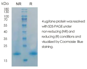 Human IL13 Recombinant Protein (HEK293 Expression) — Tag Free