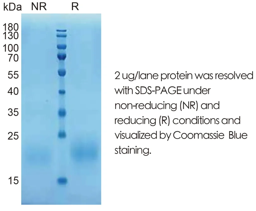 Human IL15 Recombinant Protein (HEK293 Expression) - Image 1