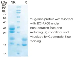Human IL17A Recombinant Protein (HEK293 Expression) — Tag Free