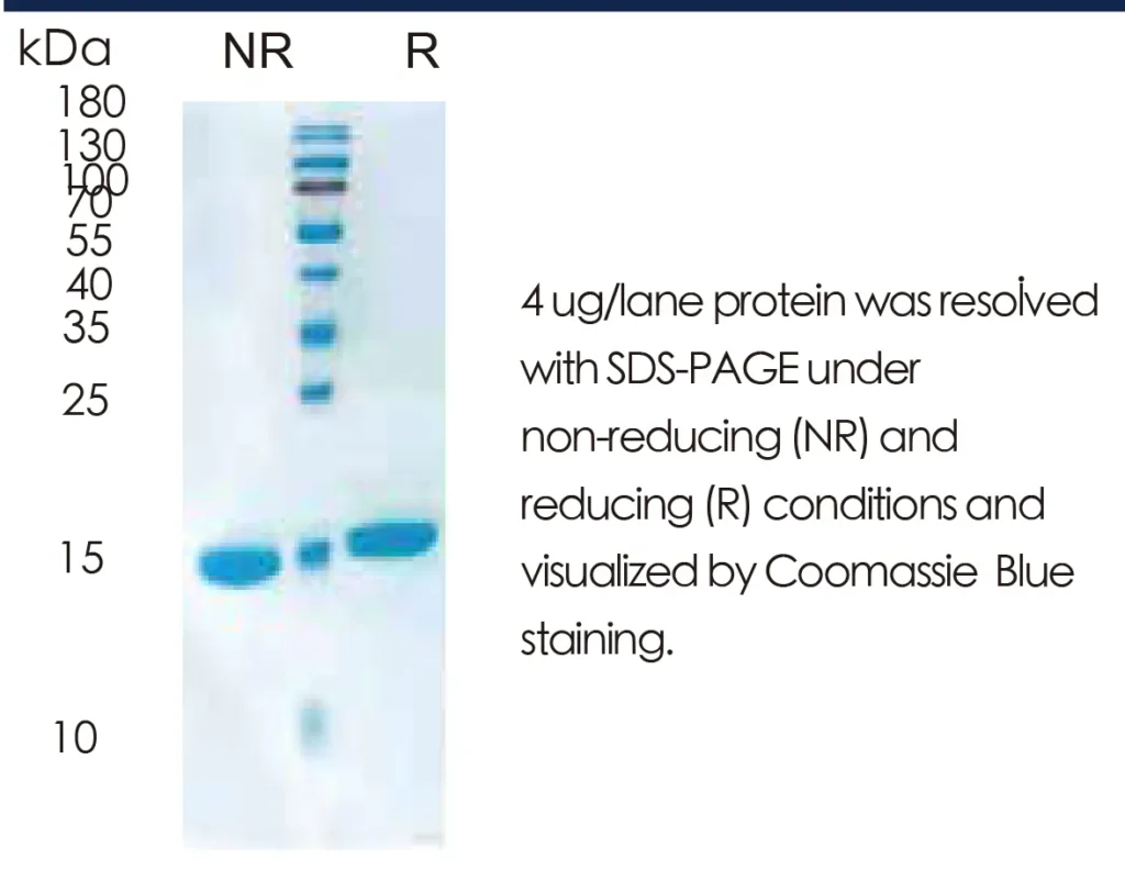 Human IL21 Recombinant Protein (HEK293 Expression) — Tag Free - Image 1