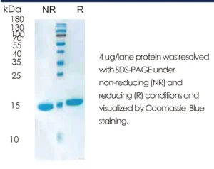 Human IL21 Recombinant Protein (HEK293 Expression) — Tag Free