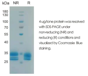 Human IL27 Recombinant Protein (HEK293 Expression) — Tag Free