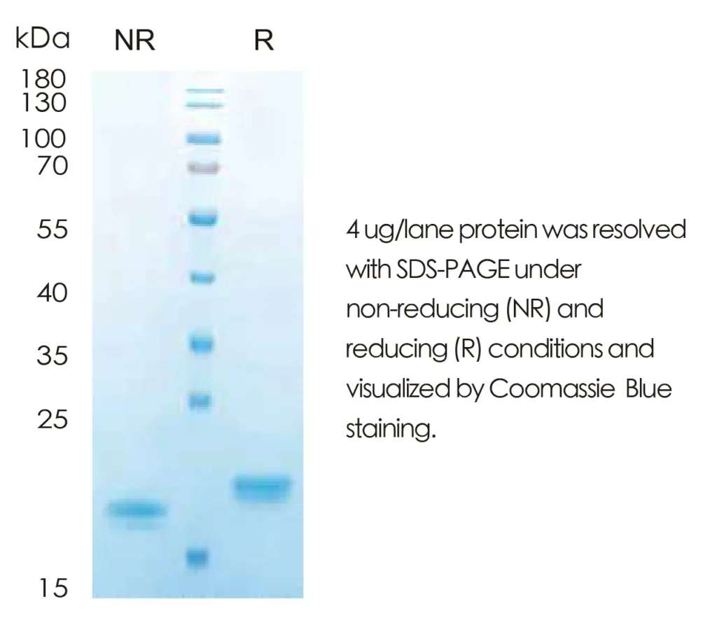Human IL28A Recombinant Protein (HEK293 Expression) — Tag Free - Image 1