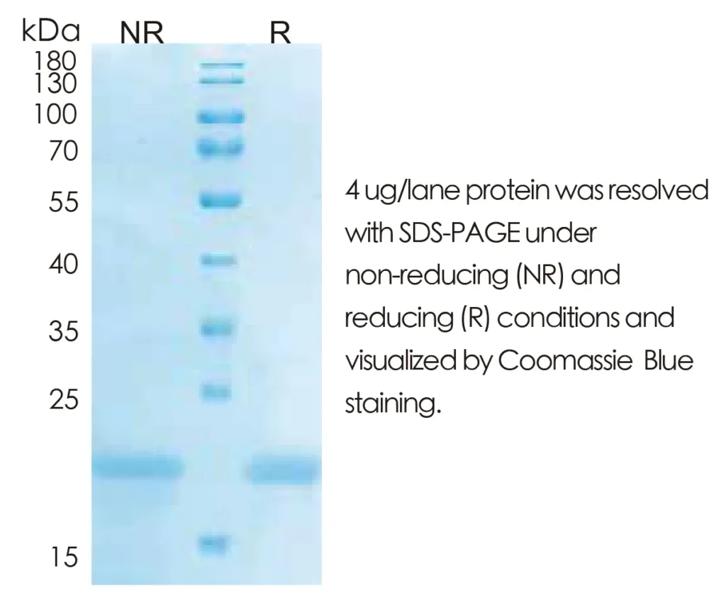 Human IL28B Recombinant Protein (HEK293 Expression) — Tag Free - Image 1