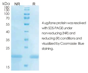 Human IL28B Recombinant Protein (HEK293 Expression) — Tag Free