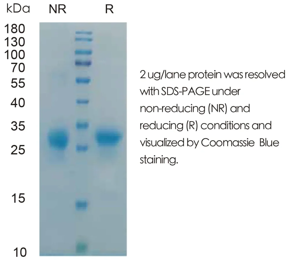 Human IL29 Recombinant Protein (HEK293 Expression) — Tag Free - Image 1