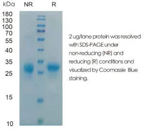Human IL29 Recombinant Protein (HEK293 Expression) — Tag Free