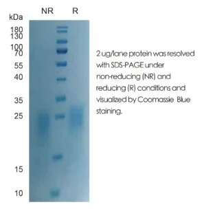 Human CSF2 Recombinant Protein (HEK293 Expression) — Tag Free