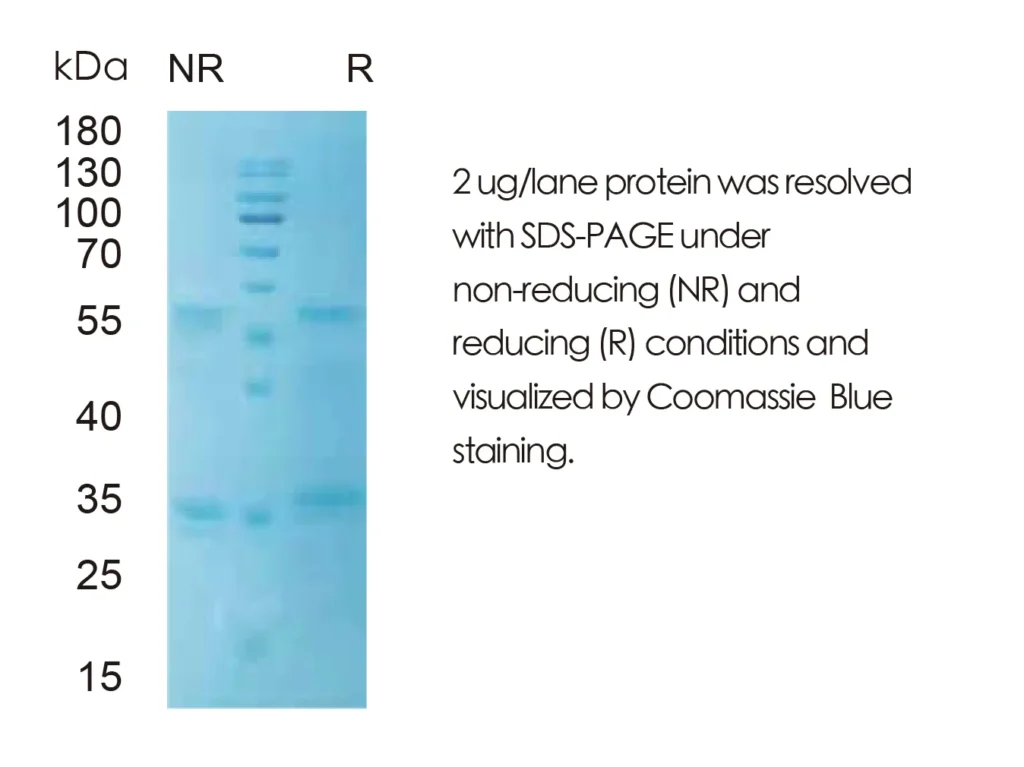 Human CSF3 Recombinant Protein (HEK293 Expression) — Tag Free - Image 1