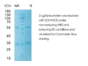 Human CSF3 Recombinant Protein (HEK293 Expression) — Tag Free