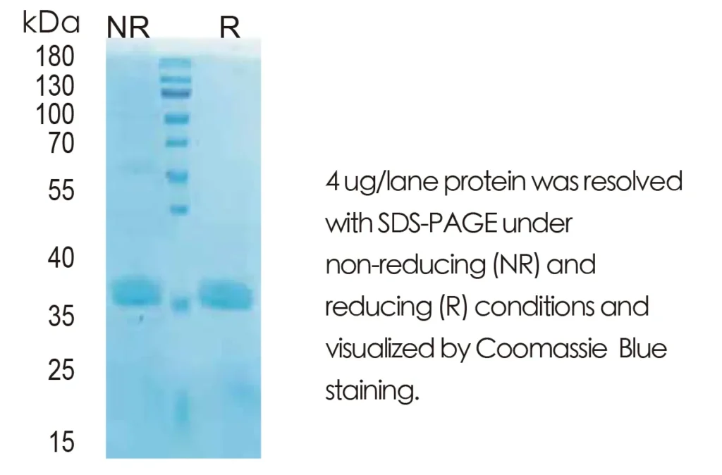 Human CD40L Recombinant Protein (HEK293 Expression) — Tag Free - Image 1
