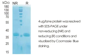 Human CD40L Recombinant Protein (HEK293 Expression) — Tag Free