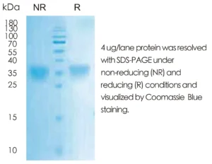 Human EPO Recombinant Protein (HEK293 Expression) — Tag Free