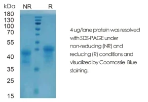 Human FLT3L Recombinant Protein (HEK293 Expression) — Tag Free
