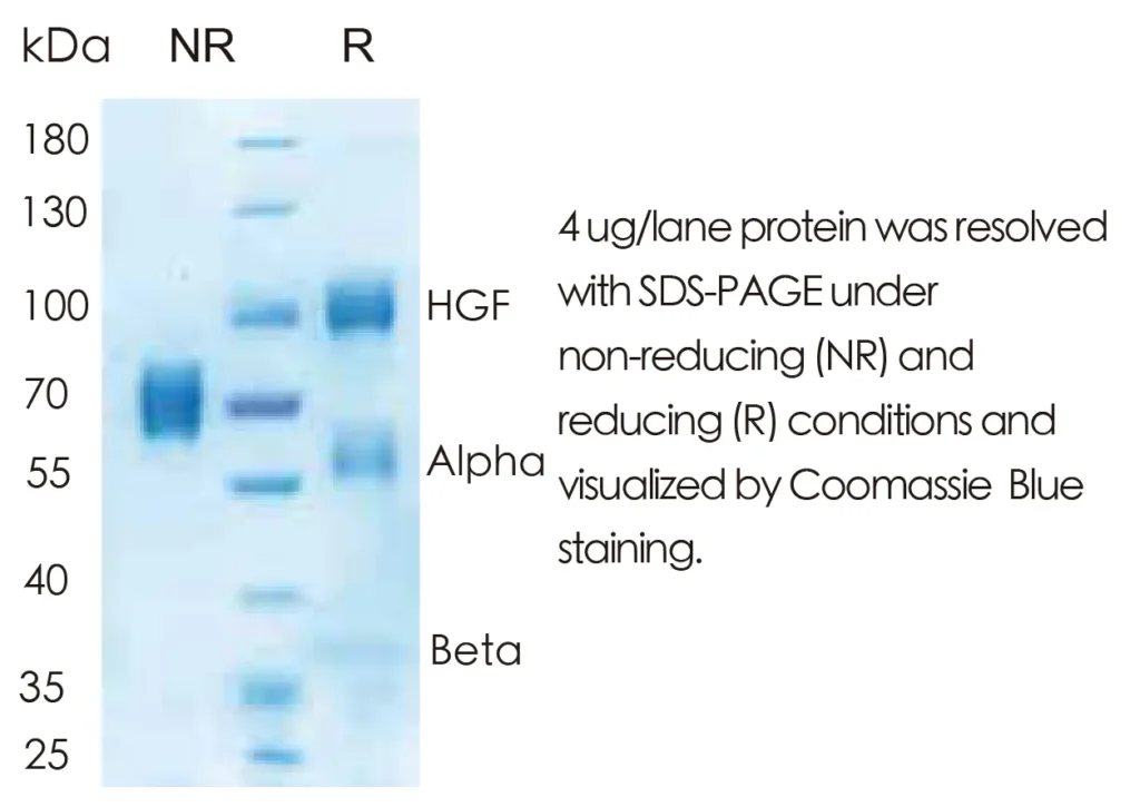 Human HGF Recombinant Protein (HEK293 Expression) — Tag Free - Image 1