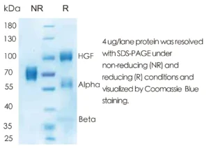 Human HGF Recombinant Protein (HEK293 Expression) — Tag Free
