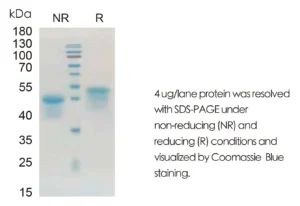 Human OSM Recombinant Protein (HEK293 Expression) — Tag Free