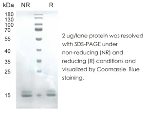 Human TNFa Recombinant Protein (HEK293 Expression) — Tag Free