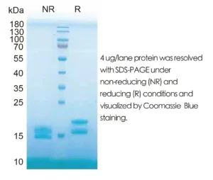 Human IFNA2 Recombinant Protein (HEK293 Expression) — Tag Free