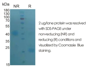 Human GDNF Recombinant Protein (HEK293 Expression) — Tag Free