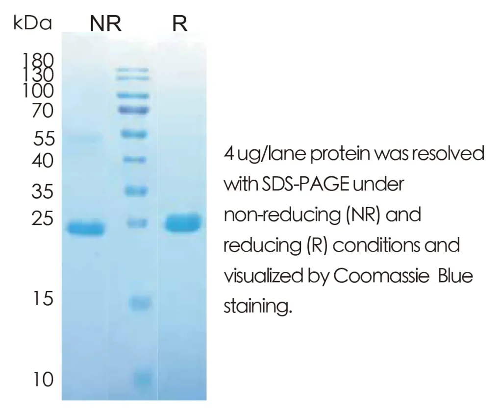 Human FGF7 Recombinant Protein (HEK293 Expression) — Tag Free - Image 1