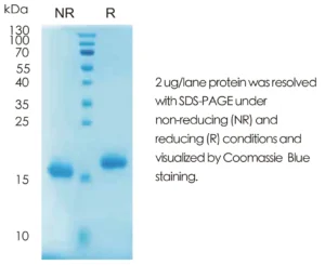Human FGF2 Recombinant Protein (HEK293 Expression) — Tag Free
