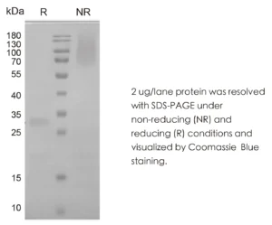 Human Noggin Recombinant Protein (HEK293 Expression) — Tag Free