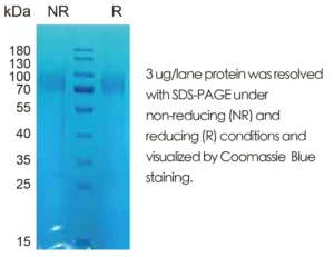 Human TPO Recombinant Protein (HEK293 Expression) — Tag Free