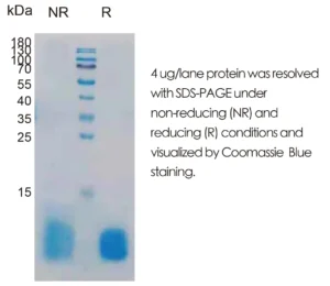 Human IGF1 Recombinant Protein (HEK293 Expression) — Tag Free