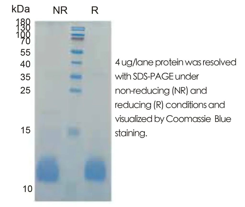 Human IGF2 Recombinant Protein (HEK293 Expression) — Tag Free - Image 1