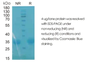 Mouse IL2 Recombinant Protein (HEK293 Expression) — Tag Free