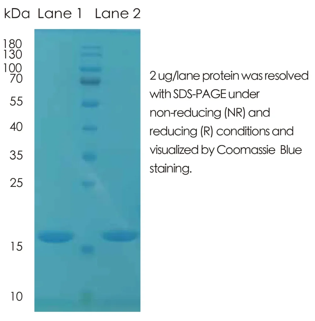Mouse IL1b Recombinant Protein (HEK293 Expression) — Tag Free - Image 1
