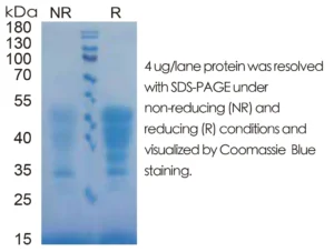 Mouse SCF Recombinant Protein (HEK293 Expression) — Tag Free