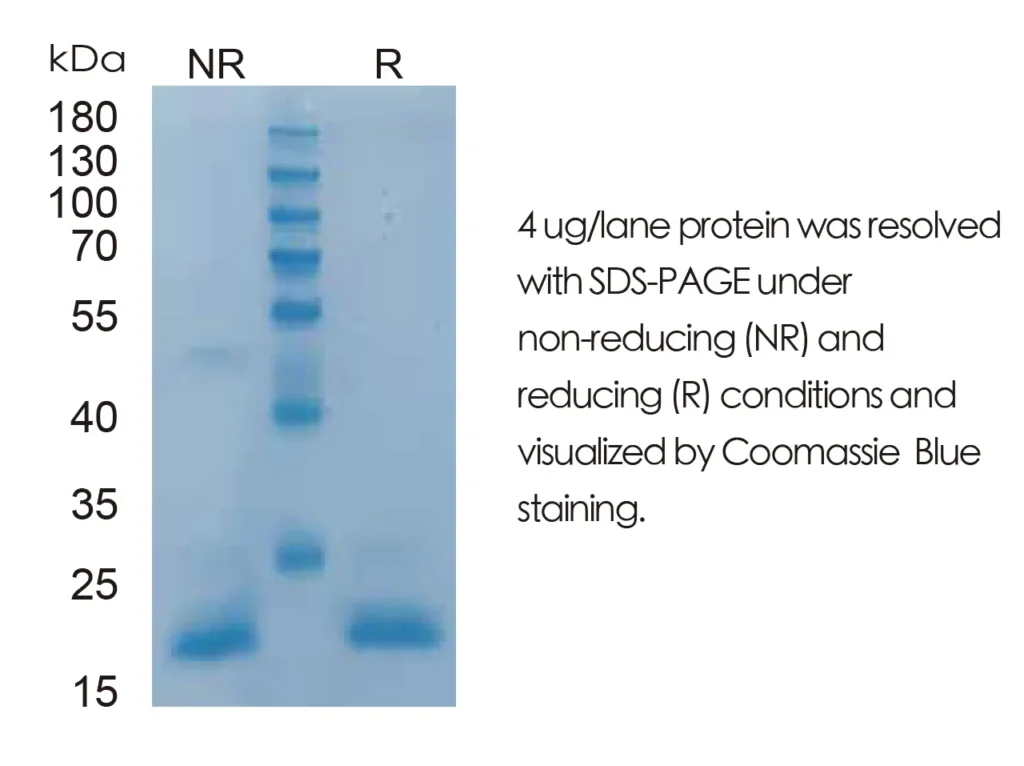 Mouse FGF2 Recombinant Protein (HEK293 Expression) — Tag Free - Image 1