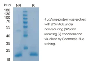 Mouse FGF2 Recombinant Protein (HEK293 Expression) — Tag Free