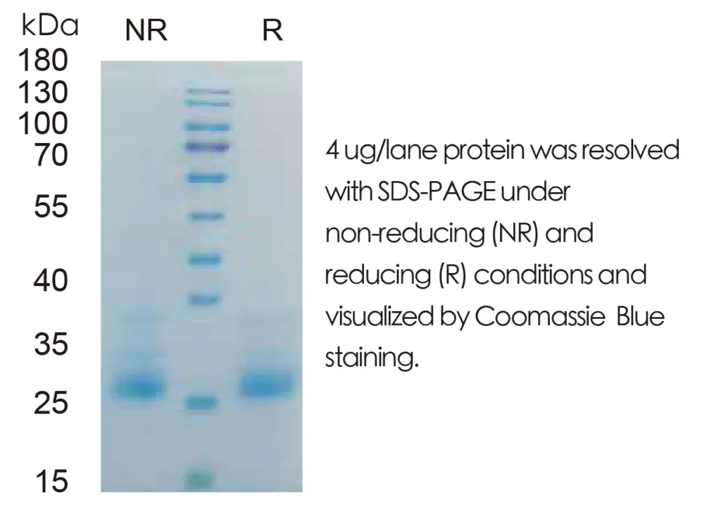 Mouse IFNg Recombinant Protein (HEK293 Expression) — Tag Free - Image 1