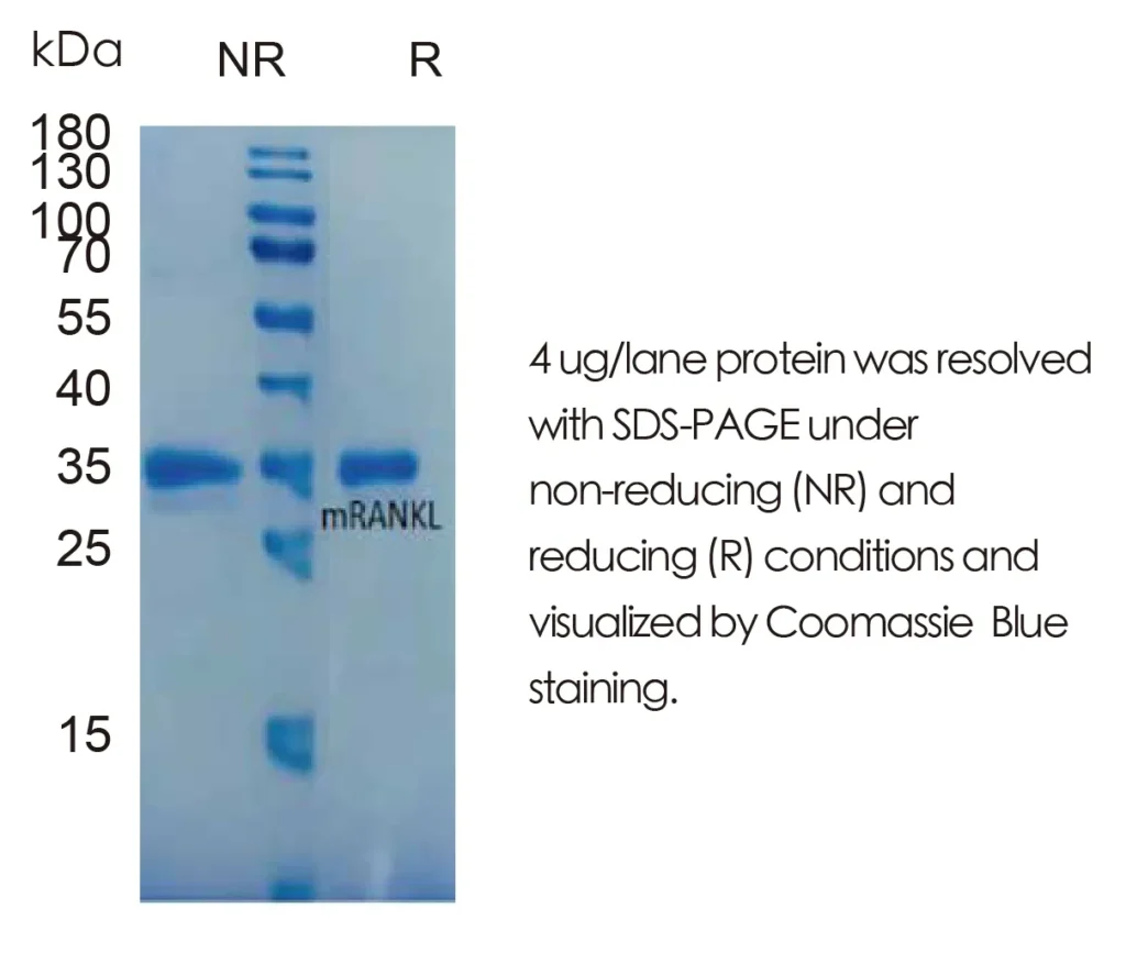 Mouse RANKL Recombinant Protein (HEK293 Expression) — Tag Free - Image 1